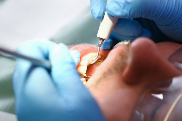 Best Weekend Emergency Dentist in Paincourtville, LA
